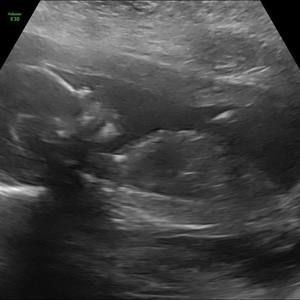 Meet your Posher, Shane